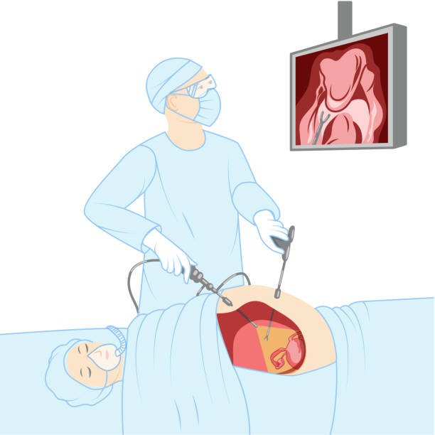Laparoscopic surgery being performed by a surgeon at Kaiwalya Hospital Indore with advanced medical technology